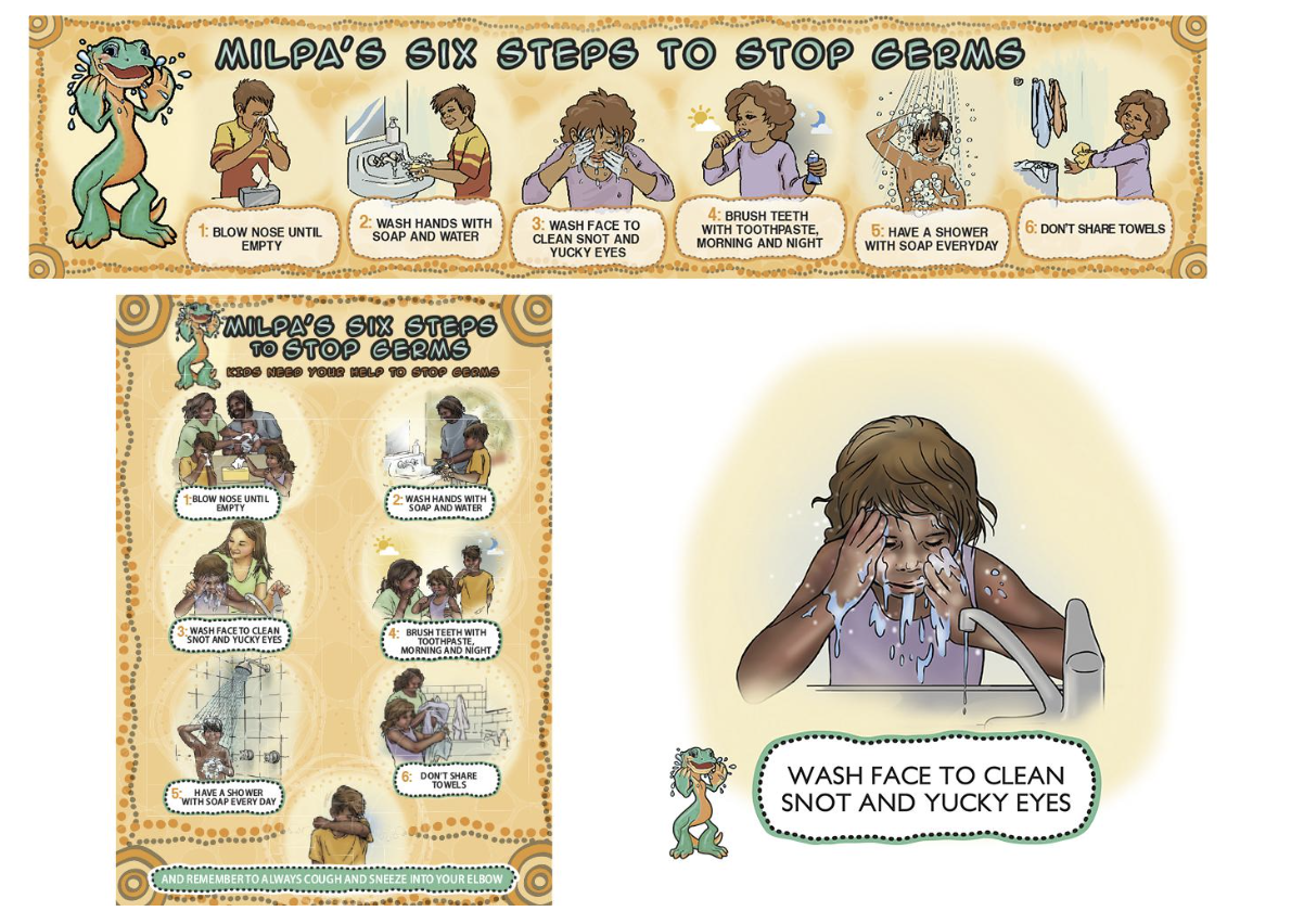 Milpa's Six Steps to Stop Germs' trachoma resources