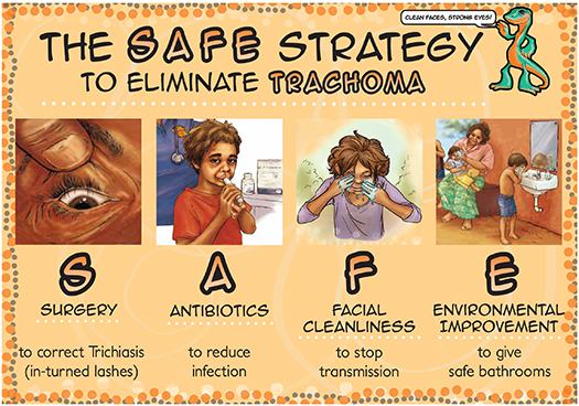 SAFE card image