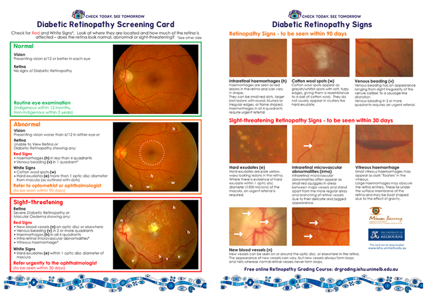 CTST DR screening card
